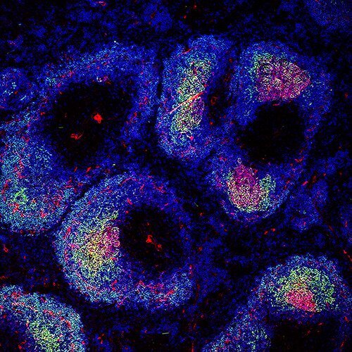 A picture of germinal center (pink-yellow) in B cell follicles (blue) in the spleen