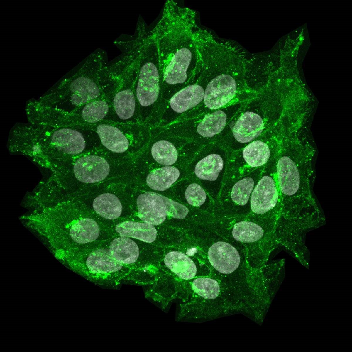 Human embryonic stem cell. Photo: Sarita Panula