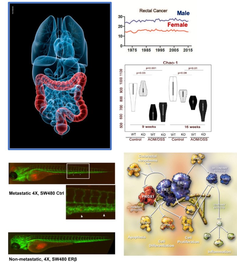 images and graphs of colorectal cancer and cells