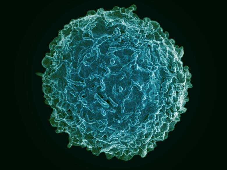 Colorized scanning electron micrograph of a human B cell.