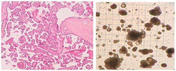 A: Human placenta section with H&E staining showing villous tree morphology.              B: Human placental organoid culture