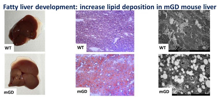 increased lipid deposition in mGD mouse liver