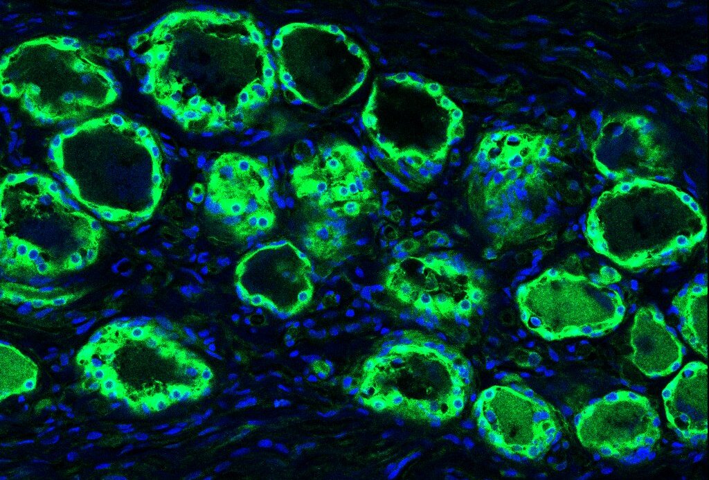 Immunohistochemistry (IHC) in human dorsal root ganglia; 20x magnification.