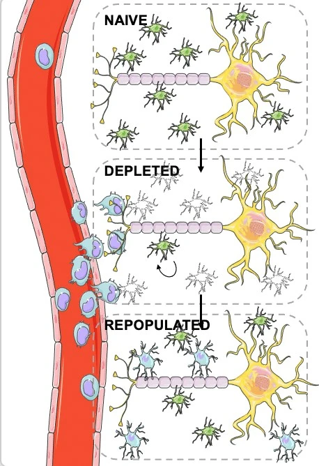Allogeneic MHC-mismatched microglia-like cell replacement as a therapeutic approach for Multiple Sclerosis