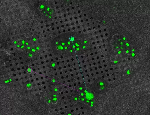 Cryo-CLEM of GFP labelled yeast, collected at the 3D-EM Core Facility.