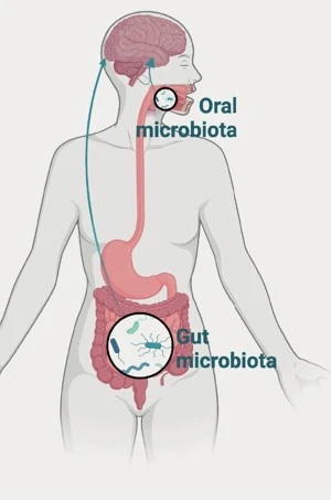 EpiGUT Epilepsi poster