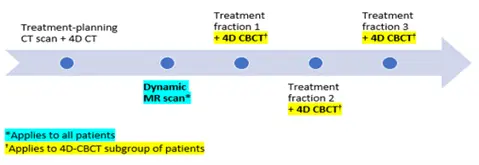 Schematisk bild av radiologiska interventioner för utvärdering av tumörrörelser.