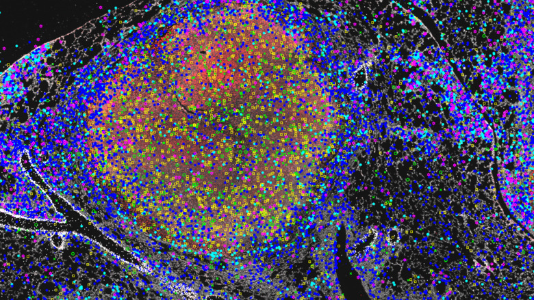 An example of transcript colocalization in TB granulomas.