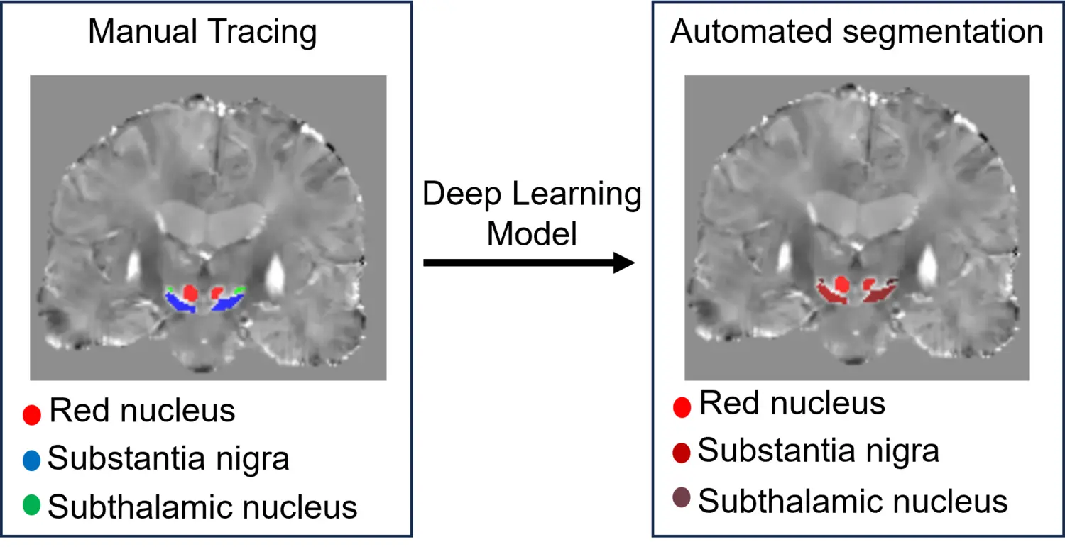 Deep learning model.