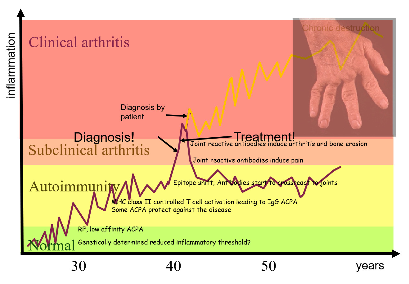 Course of disease for clinical arthritis