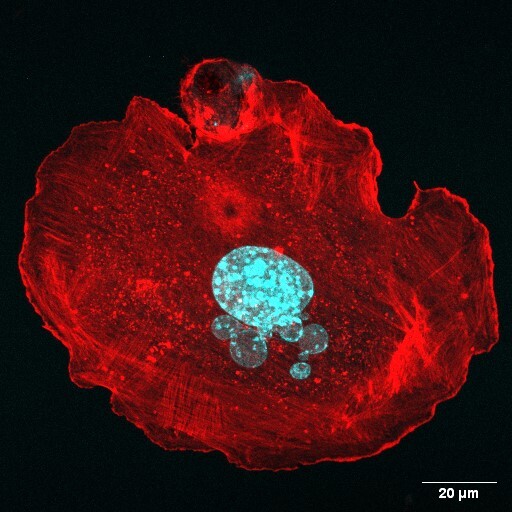 A lab picture of he actin cytoskeleton (red) in a megakaryocyte (nucleus, blue)