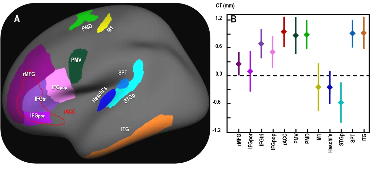 Brain anatomy of adult monozygotic twins that differed in their musical experience.