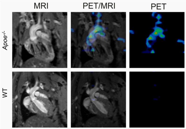 Magnetic resonance (MR) with PET | Karolinska Institutet