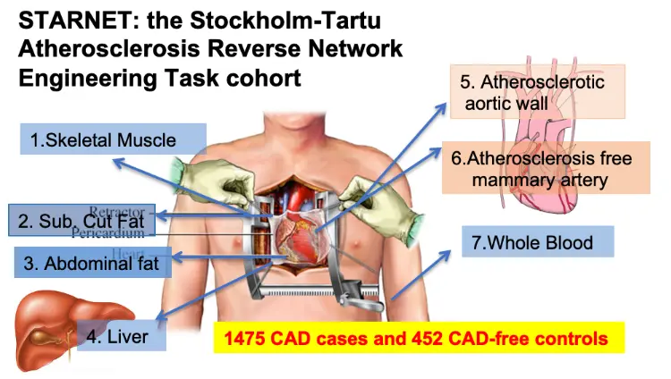 Grafisk illustration av torso som är öppnad i brösthöjd för hjärtoperation.