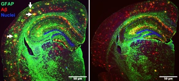 Microscopy images in mostly green and black