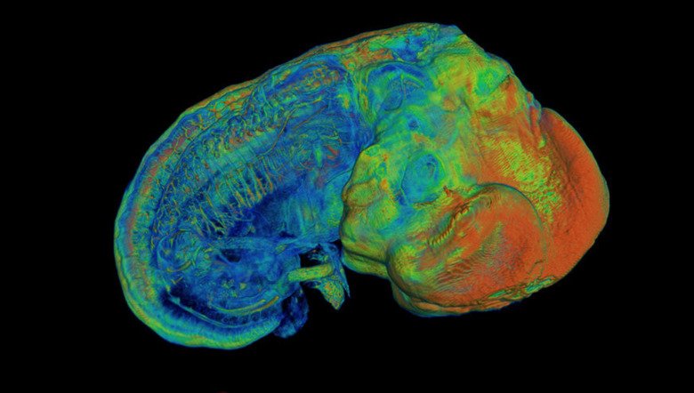Image from Biomedicum Imaging Core. Credit: Shigeaki Kanatani.