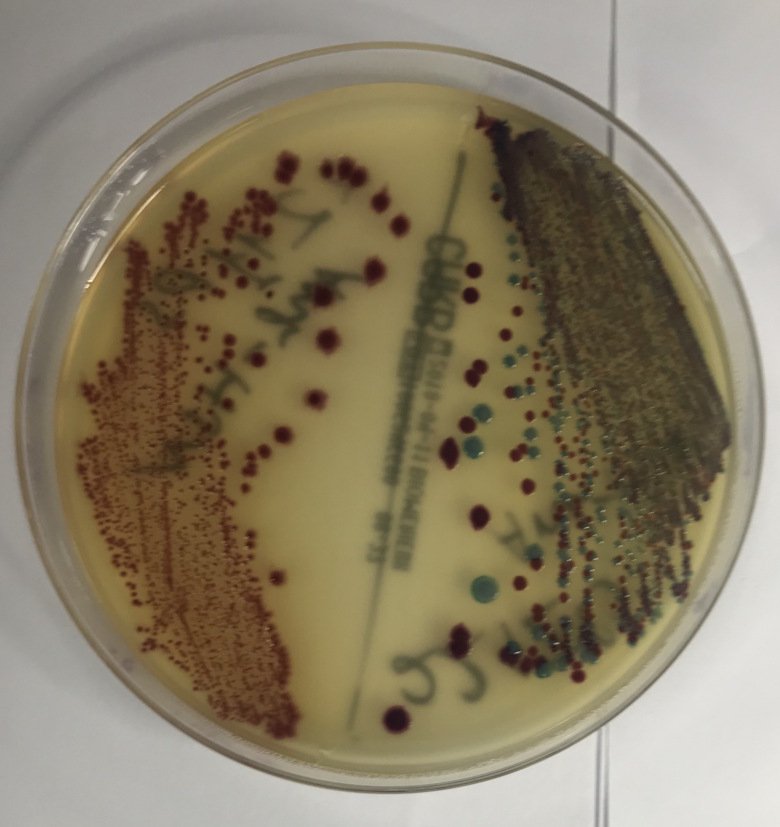 CRE (Carbapenem-resistant Enterobacteriaceae) bacteria-