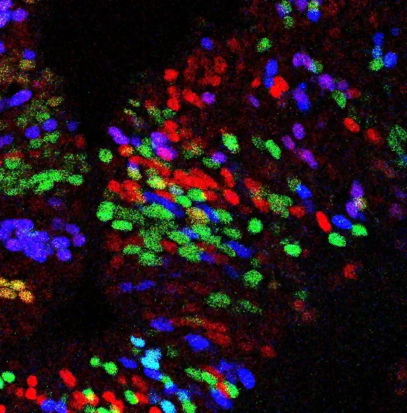 Cell clones in different colors