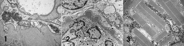 Photo of Clinical electron microscopy