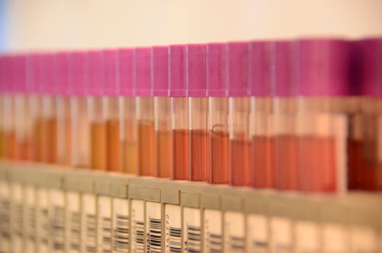 Tubes in racks at KI Biobank