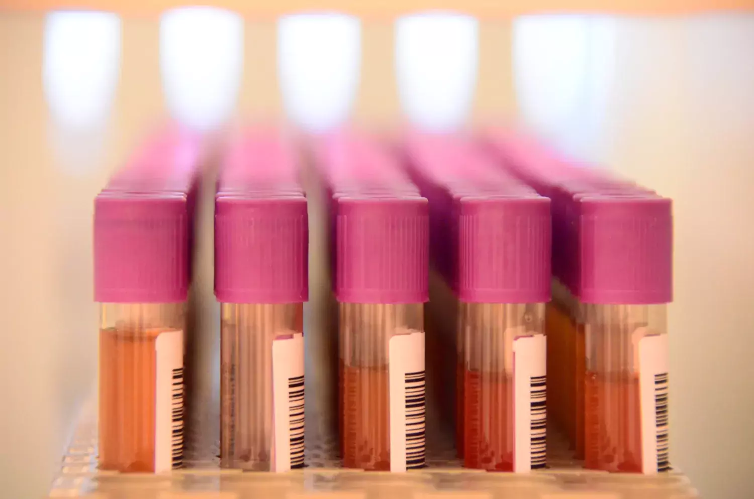 Tubes in a rack at KI Biobank