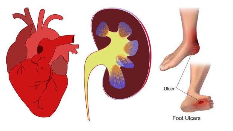 Some organs with diabetes related complications.