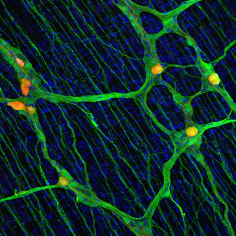 Photo of the Enteric Nervous System