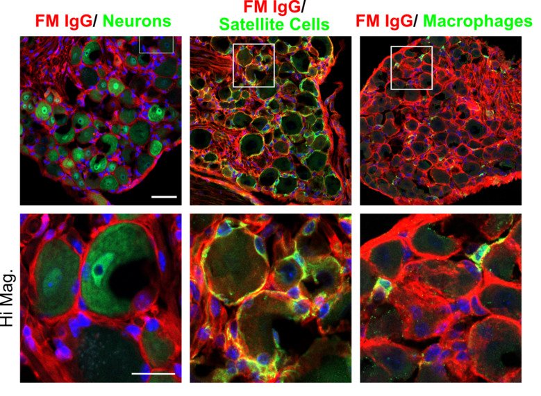 A lab picture of FM IgG accumulates in the DRG and binds satellite glial cells