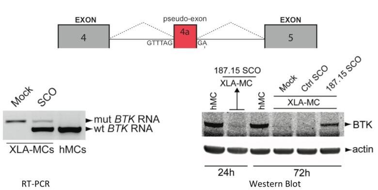 Graphic illustration of Fig. 2 Splice correction of human mutated BTK mRNA using splice switching ONs. At top a schematic illustration of the mutation creating a pseudo exon leading to in frame premature stop codon.