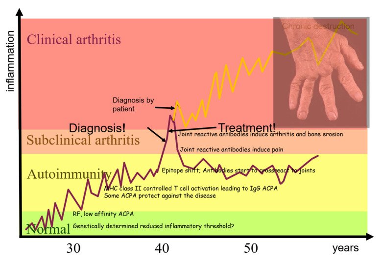 Course of disease for clinical arthritis
