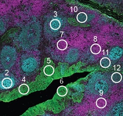 Spatial Biology GeoMx