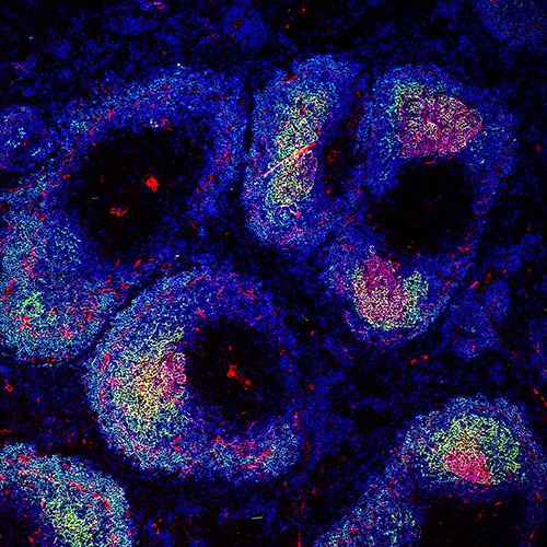 A picture of the germinal center (pink-yellow) in B cell follicles (blue) in the spleen.