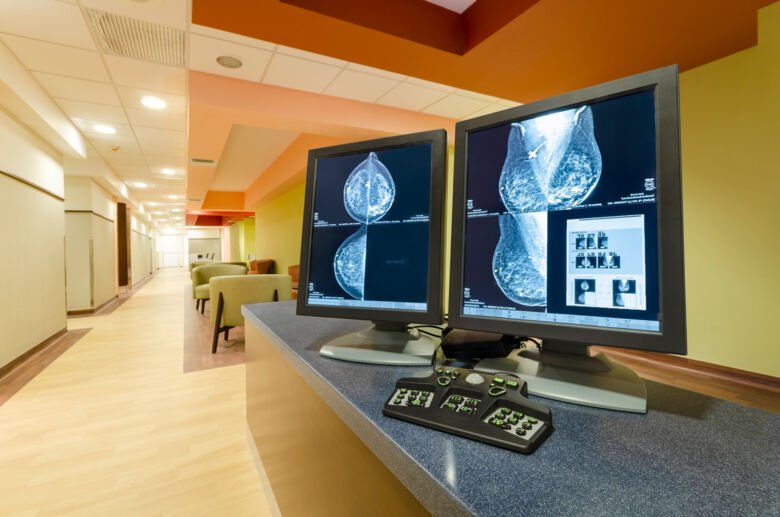 Mammografibild på datorskärm