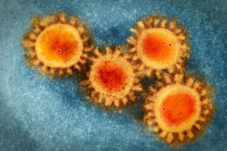 Coronavirus