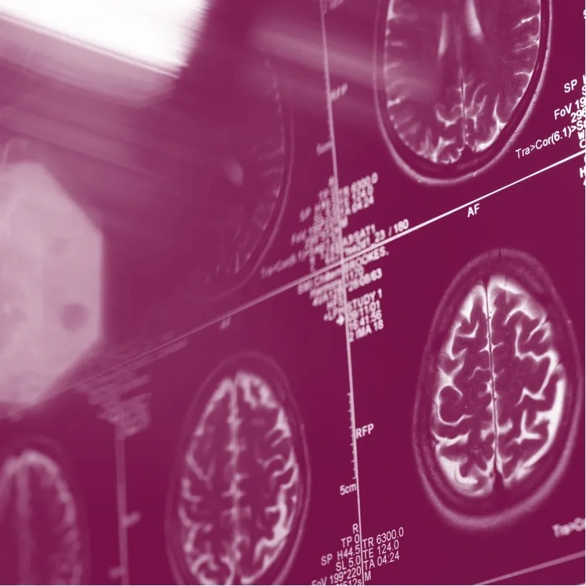 Medical imaging data scan of a brain