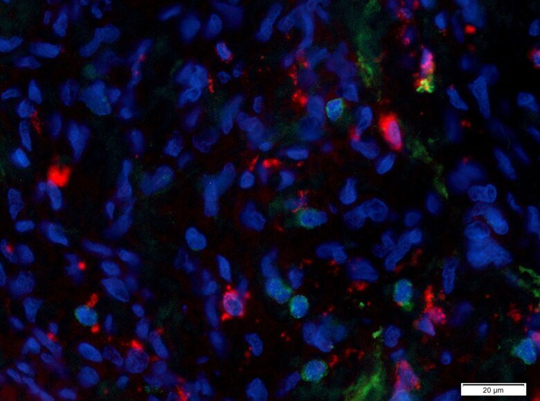 Immunofluorescent staining: Healthy prostates