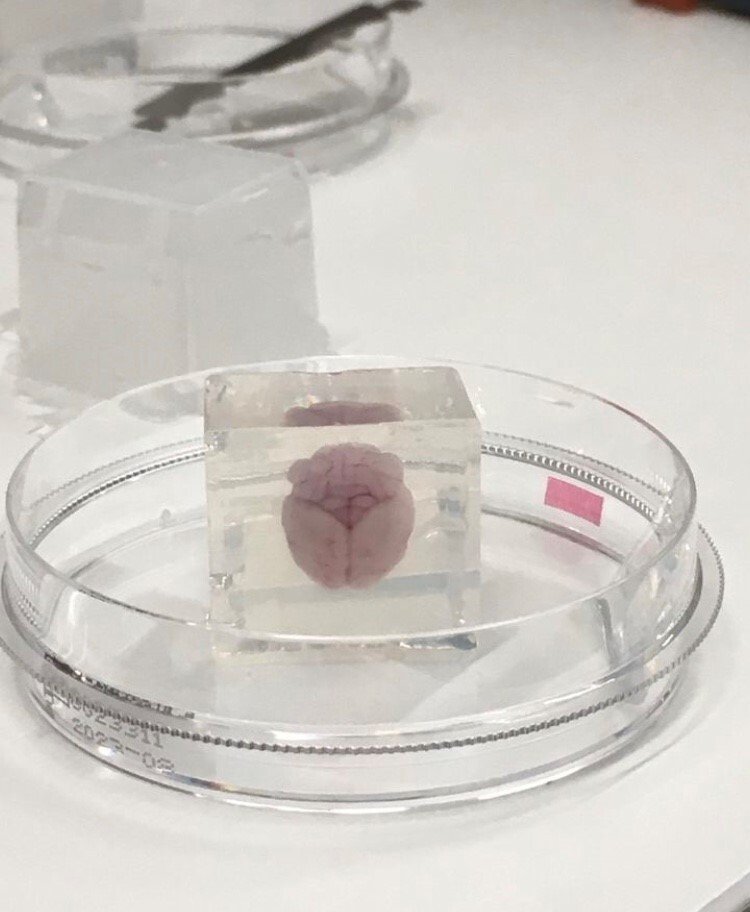 Picture of Another - Mouse brain prepared for slicing in Vibratome Leica VT 100ST