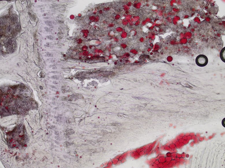 Oil-Red staining of bone