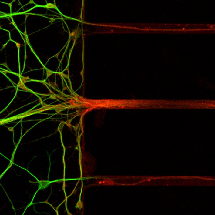 Microscopic image of motor axons in green and red.