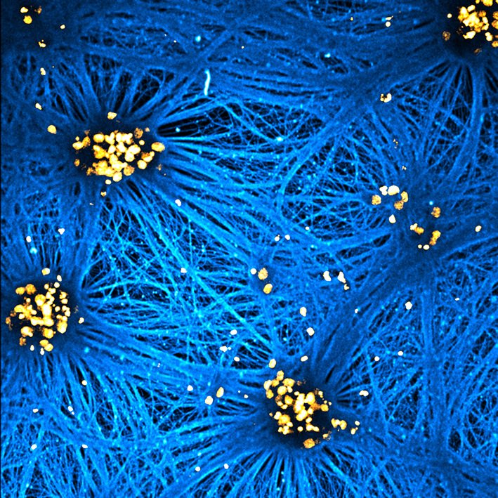 Microscopic image of motor neurons in blue and yellow.