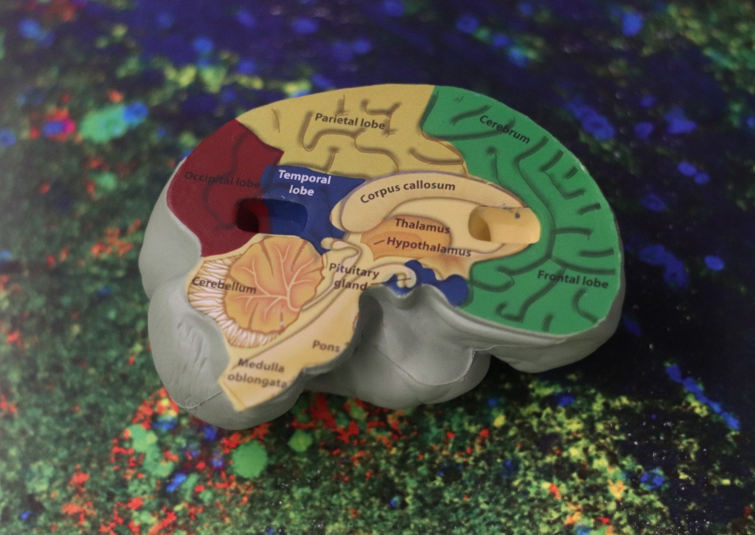 avbildning av genomskuren hjärnmodell med färgade områden som beskriver vad som är vad.