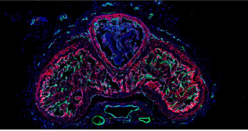 Corpora cavernosa of the mouse penis:  A cross-section image of a mouse penis. Cells in red represent fibroblasts, while cells in green denote vascular smooth muscle cells, and cells in cyan indicate endothelial cells.