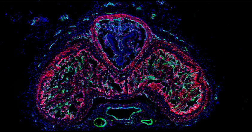 Corpora cavernosa of the mouse penis:  A cross-section image of a mouse penis. Cells in red represent fibroblasts, while cells in green denote vascular smooth muscle cells, and cells in cyan indicate endothelial cells.