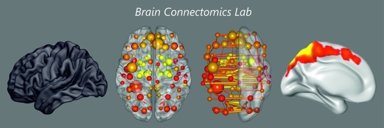 Brain Connectomics Lab