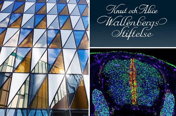Montage three pictures: on the left Aula Medica's facade, on the lower right a scientific picture of a brain in different colors, on the upper right the foundation's logo.