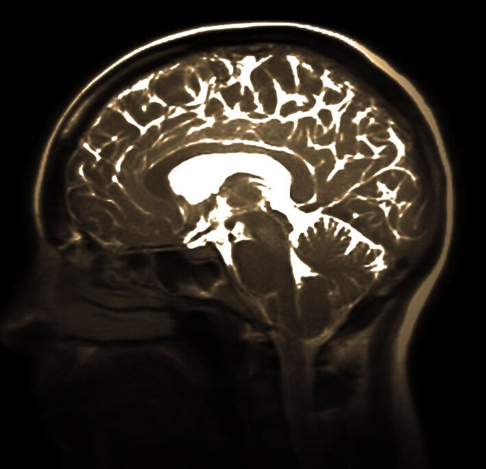 Decorative image showing three profiles with visible brains.