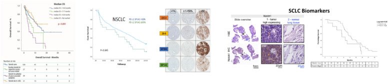 NSCLC Immunotherapy cohorts.