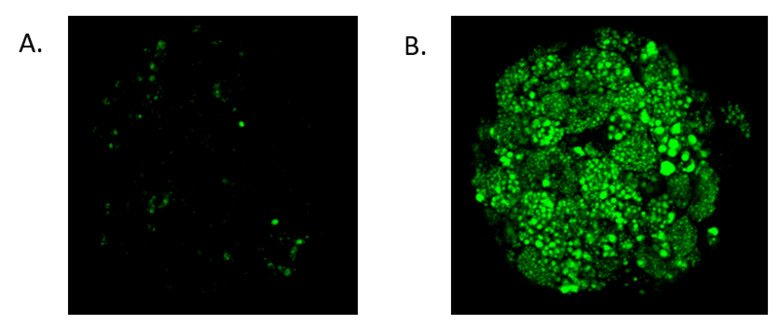 Fig 2. Induction of steatosis using 2 x plasma concentration of FFA and induction of steatosis in the spheroids under metabolic syndrome conditions. A. Control conditions; B. steatotic conditions