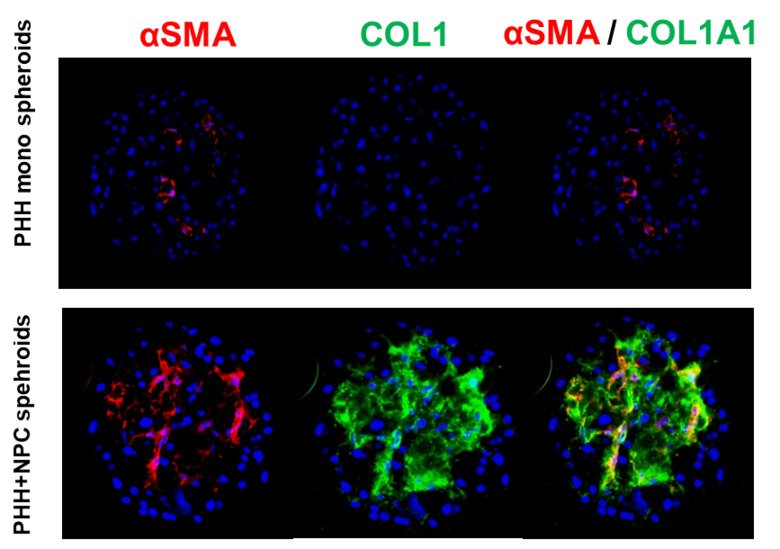 Fig 3. Induction of fibrosis as monitored by collagen 1A1 and smooth actin expression using 2 x FFA concentrations in liver spheroids composed of hepatocytes only or hepatocytes with non parenchymal cells