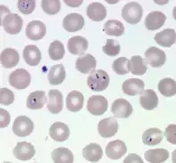Malaria parasites seen in a microscope.